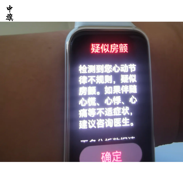 智能手環(huán)測(cè)血壓靠譜嗎？